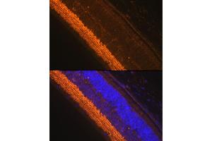 Immunofluorescence (IF) image for anti-Glutamate Decarboxylase 1 (Brain, 67kDa) (GAD1) (AA 1-200) antibody (ABIN3017019)