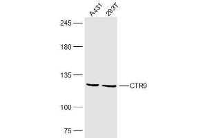 Lane 1: A431 lysates Lane 2: 293T lysates probed with CTR9 Polyclonal Antibody, Unconjugated  at 1:300 dilution and 4˚C overnight incubation. (CTR9 抗体  (AA 751-850))