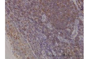 Image no. 1 for anti-ARP3 Actin-Related Protein 3 (ACTR3) (AA 1-419) antibody (ABIN599115) (ACTR3 抗体  (AA 1-419))