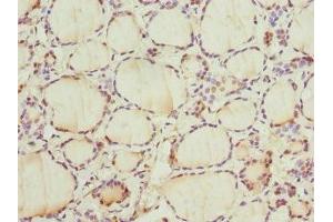 Immunohistochemistry of paraffin-embedded human thyroid tissue using ABIN7153399 at dilution of 1:100 (Cyclin E2 抗体  (AA 255-404))