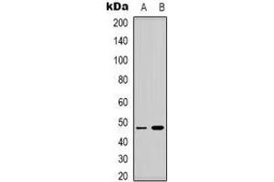 Western blot analysis of Lupus La (pS366) expression in HEK293T (A), MCF7 (B) whole cell lysates. (Lupus La (C-Term), (pSer366) 抗体)