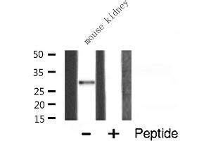 Western blot analysis of RPS4X expression in Mouse kidney lysate (RPS4X 抗体  (Internal Region))