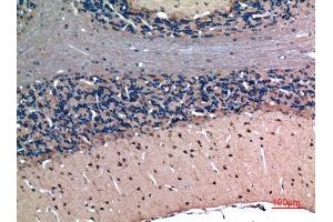 Immunohistochemistry (IHC) analysis of paraffin-embedded Rat Brain, antibody was diluted at 1:100. (Latexin 抗体  (Internal Region))