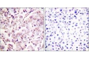 Immunohistochemistry (IHC) image for anti-V-Ets erythroblastosis Virus E26 Oncogene Homolog 1 (Avian) (ETS1) (AA 11-60), (pThr38) antibody (ABIN1531315)