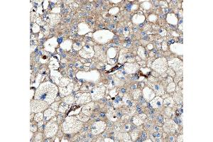 IHC analysis of Kindlin 2/FERMT2 using anti-Kindlin 2/FERMT2 antibody (ABIN7599515). (FERMT2 抗体  (AA 1-650))