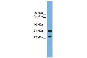 Western Blot showing CD8B antibody used at a concentration of 1-2 ug/ml to detect its target protein. (CD8B 抗体  (Middle Region))