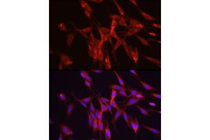 Immunofluorescence (IF) image for anti-Ornithine Decarboxylase 1 (ODC1) (AA 1-280) antibody (ABIN3015744)