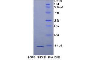 SDS-PAGE analysis of Human VEGFD Protein. (VEGFD 蛋白)