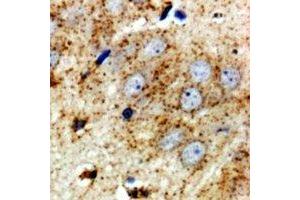 Immunohistochemistry (IHC) image for anti-Ribosomal Protein S10 (RPS10) antibody (ABIN7308290) (RPS10 抗体)