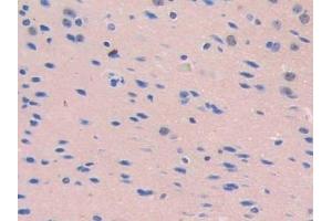 Detection of CD34 in Mouse Cerebrum Tissue using Polyclonal Antibody to Cluster Of Differentiation 34 (CD34)