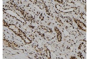 ABIN6266020 and ABIN6273186 at 1/100 staining Human kidney tissue by IHC-P. (WDR46 抗体  (Internal Region))