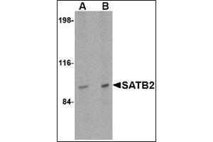 Western blot analysis of SATB2 in mouse brain tissue lysate with this product at (A) 2 and (B) 4 μg/ml.