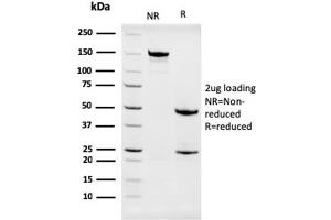 SDS-PAGE Analysis Purified Nucleophosmin Mouse Monoclonal Antibody (NPM1/3286).