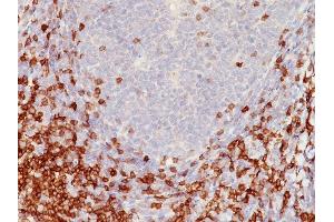 Formalin-fixed, paraffin-embedded human Tonsil stained with CD5 Mouse Monoclonal Antibody (C5/473). (CD5 抗体)