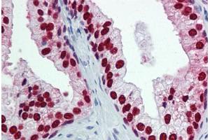 Human Prostate: Formalin-Fixed, Paraffin-Embedded (FFPE) (FOXA1 抗体  (AA 367-473))