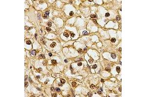 Immunohistochemical analysis of CSN1 staining in human kidney formalin fixed paraffin embedded tissue section. (GPS1 抗体)