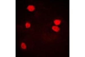 Immunofluorescent analysis of LSm4 staining in U2OS cells. (LSM4 抗体)