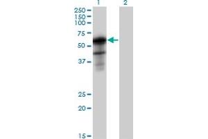 Western Blot analysis of SH2B1 expression in transfected 293T cell line by SH2B1 MaxPab polyclonal antibody. (SH2B1 抗体  (AA 1-426))