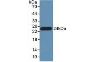 Western Blotting (WB) image for Pancreas Specific Transcription Factor, 1a (PTF1A) ELISA Kit (ABIN6574309)