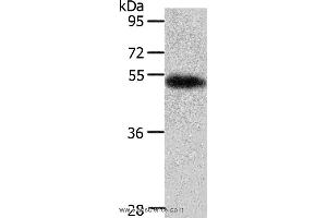 Western blot analysis of Human liver cancer tissue, using AGT Polyclonal Antibody at dilution of 1:700 (AGT 抗体)