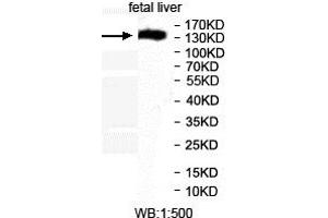 Western blot analysis of fetal liver lysates, using MEI1 antibody. (MEI1 抗体  (AA 44-237))
