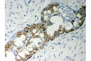 Immunohistochemistry (IHC) image for anti-Caspase 7, Apoptosis-Related Cysteine Peptidase (CASP7) (AA 117-198) antibody (ABIN3042355)
