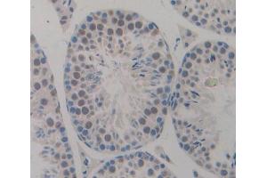Used in DAB staining on fromalin fixed paraffin- embedded testis tissue (CDKN2D 抗体  (AA 1-166))