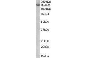 AP22427PU-N AGTPBP1 antibody staining of HeLa lysate at 1 µg/ml (35µg protein in RIPA buffer). (AGTPBP1 抗体  (Internal Region))