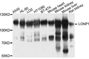 Western blot analysis of extracts of various cell lines, using LONP1 antibody. (LONP1 抗体)