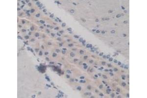 #VALUE! (KERA 抗体  (AA 21-292))
