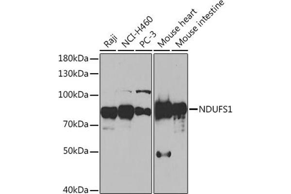 NDUFS1 抗体  (AA 80-290)