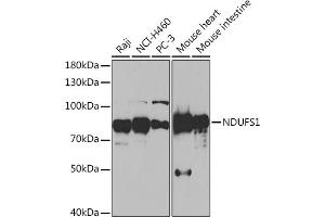 Western blot analysis of extracts of various cell lines, using NDUFS1 Rabbit pAb (ABIN7268819) at 1:1000 dilution. (NDUFS1 抗体  (AA 80-290))