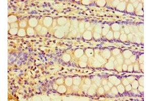 Immunohistochemistry of paraffin-embedded human colon tissue using ABIN7147675 at dilution of 1:100 (CHRFAM7A 抗体  (AA 1-150))