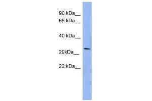 WB Suggested Anti-RRAD Antibody Titration: 0. (RRAD 抗体  (Middle Region))