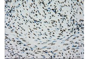 Image no. 1 for anti-Premelanosome Protein (PMEL) antibody (ABIN1500300) (Melanoma gp100 抗体)