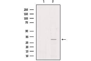 Western blot analysis of extracts from Hela, using NKX62 Antibody. (NKX6-2 抗体)