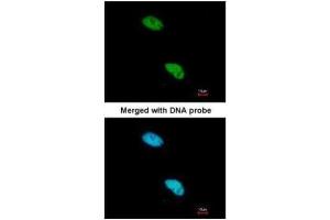 ICC/IF Image Immunofluorescence analysis of paraformaldehyde-fixed HeLa, using CBP80 , antibody at 1:200 dilution. (NCBP1 抗体  (N-Term))