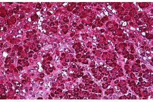 Human Adrenal: Formalin-Fixed, Parraffin-Embedded (FFPE) (Ferredoxin Reductase 抗体)