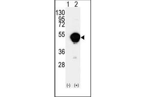 Western blot analysis of CYP20A1(arrow) using rabbit polyclonal CYP20A1 Antibody (CYP20A1 抗体  (C-Term))