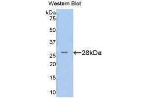 Detection of Recombinant TMEM173, Human using Polyclonal Antibody to Transmembrane Protein 173 (TMEM173) (STING/TMEM173 抗体  (AA 159-373))