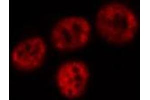 ABIN6277745 staining HeLa cells by IF/ICC. (MDM4-binding Protein 抗体  (Internal Region))