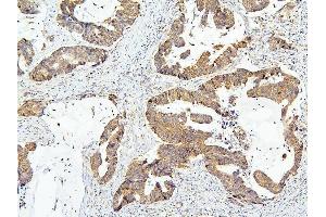 IHC analysis of OLMF4 using anti-OLMF4 antibody (ABIN6719350). (Olfactomedin 4 抗体  (AA 91-510))