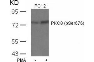 Image no. 4 for anti-Protein Kinase C, theta (PRKCQ) (pSer676) antibody (ABIN197071) (PKC theta 抗体  (pSer676))