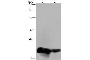 Western Blot analysis of Human placenta and breast infiltRative duct tissue using CSH1 Polyclonal Antibody at dilution of 1:200 (CSH1 抗体)