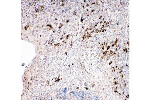 Immunohistochemistry (IHC) image for anti-TNF Receptor-Associated Factor 2 (TRAF2) (AA 305-325), (Middle Region) antibody (ABIN3044047)