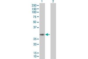 Western Blot analysis of PCSK4 expression in transfected 293T cell line ( H00054760-T01 ) by PCSK4 MaxPab polyclonal antibody. (PCSK4 抗体  (AA 1-242))