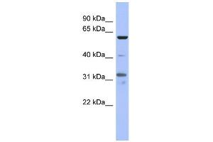 WB Suggested Anti-PAX8 Antibody Titration:  0. (PAX8 抗体  (Middle Region))