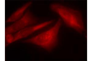 Immunofluorescence staining of methanol-fixed HeLa cells using G3BP1 (phospho S232) polyclonal antibody .