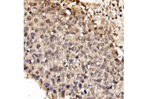 IHC analysis of IFI16 using anti-IFI16 antibody (ABIN7600374). (IFI16 抗体  (AA 183-743))