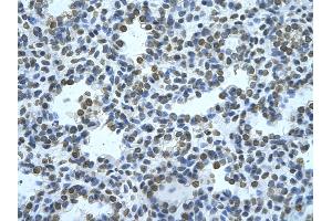 Rabbit Anti-ZMYND11 Antibody       Paraffin Embedded Tissue:  Human alveolar cell   Cellular Data:  Epithelial cells of renal tubule  Antibody Concentration:   4. (ZMYND11 抗体  (N-Term))